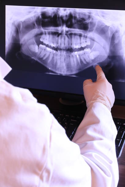 Best Emergency Wisdom Teeth Removal in Hubbard, TX