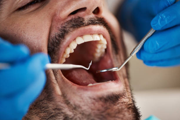 Best Emergency Dental Care for Trauma or Injury in Hubbard, TX
